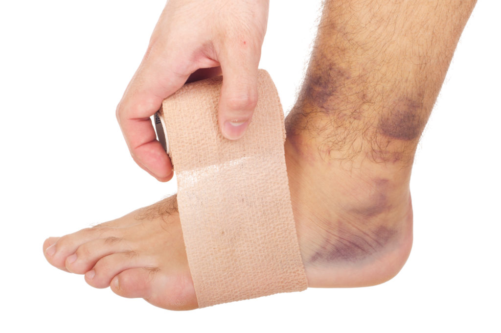 Oils For Bruises